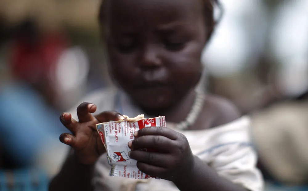 Life-saving therapeutic baby food